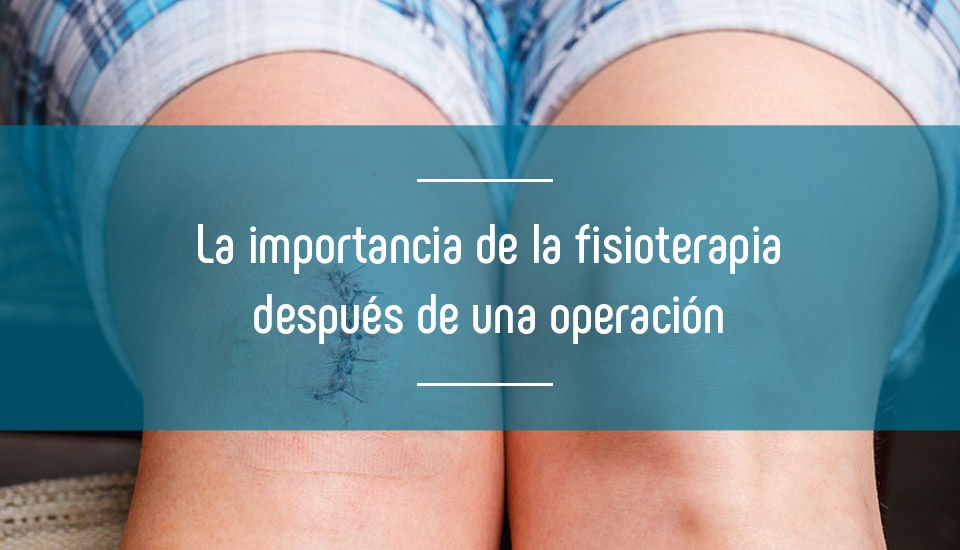 La fisioterapia después de una operación