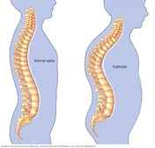 Los problemas en las estructuras no contráctiles causados por el “cuello de texto”