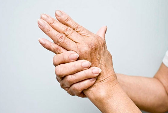 Tratamiento de fisioterapia para el reuma